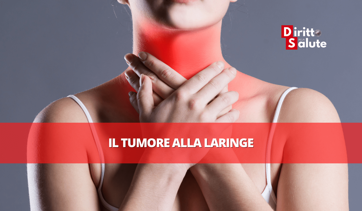 Il tumore alla laringe