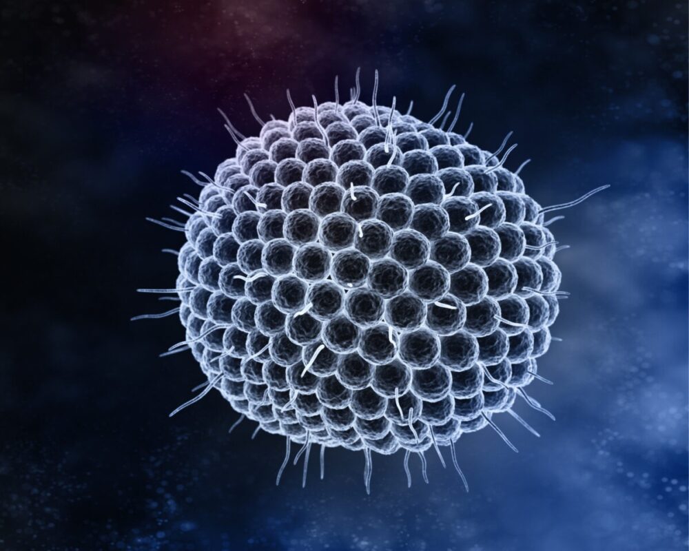 Varicella zoster virus