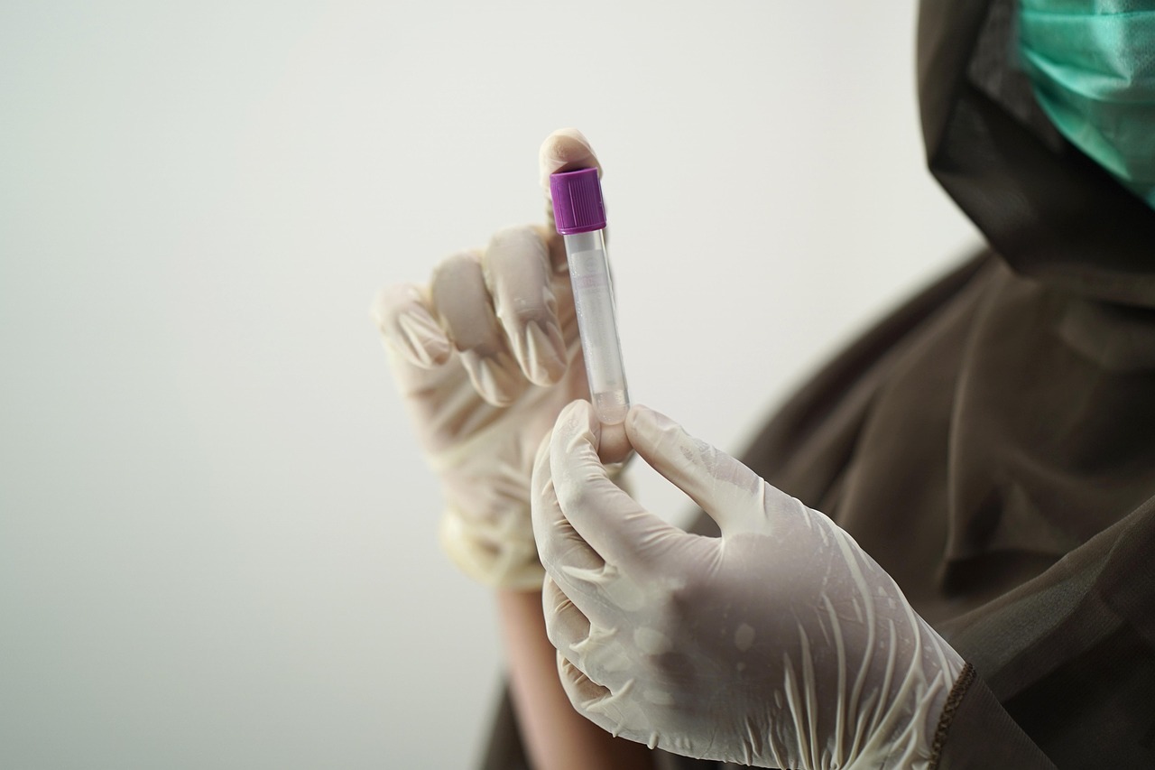 Sangue, (Foto free di Shameer Pk da Pixabay)