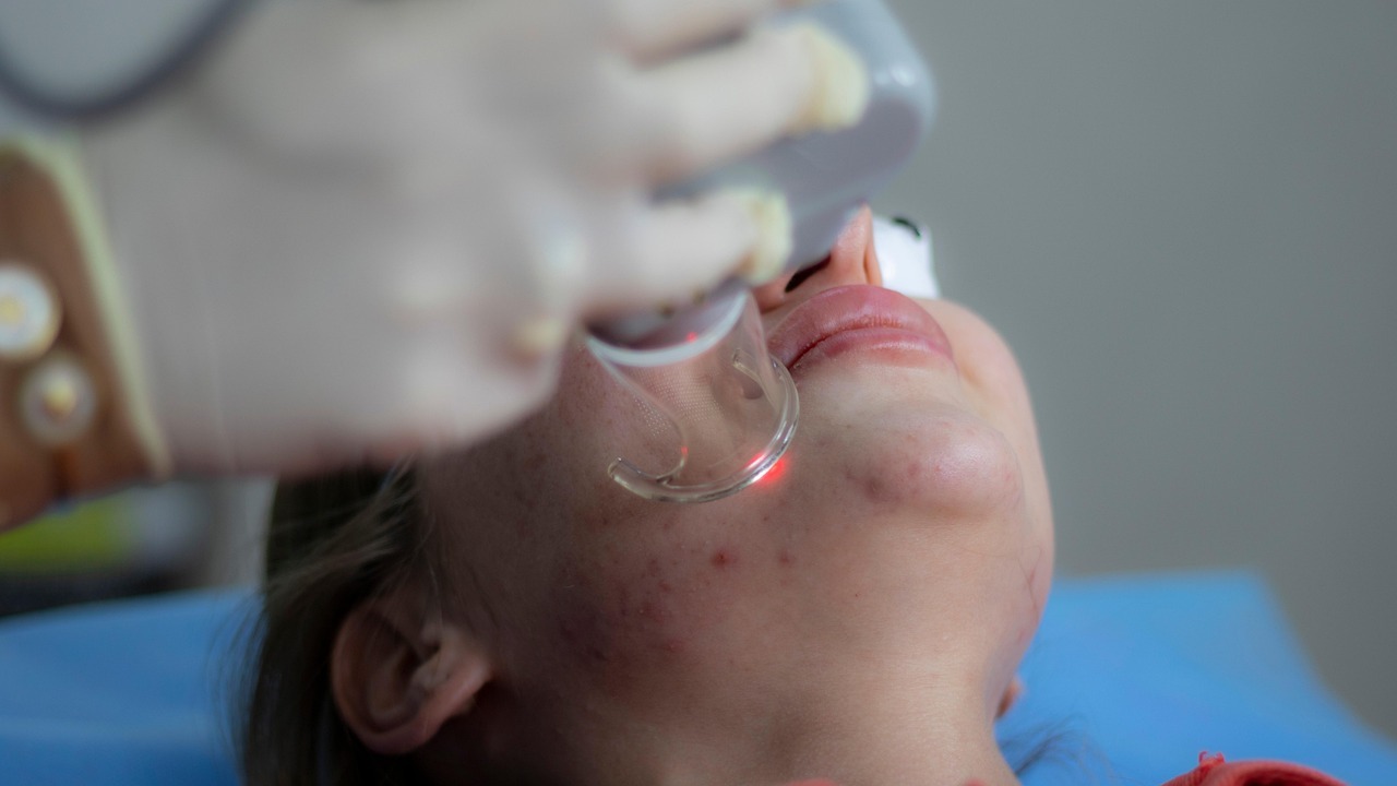 Tumori della pelle (foto esclusivamente decorativa free di Pixabay)