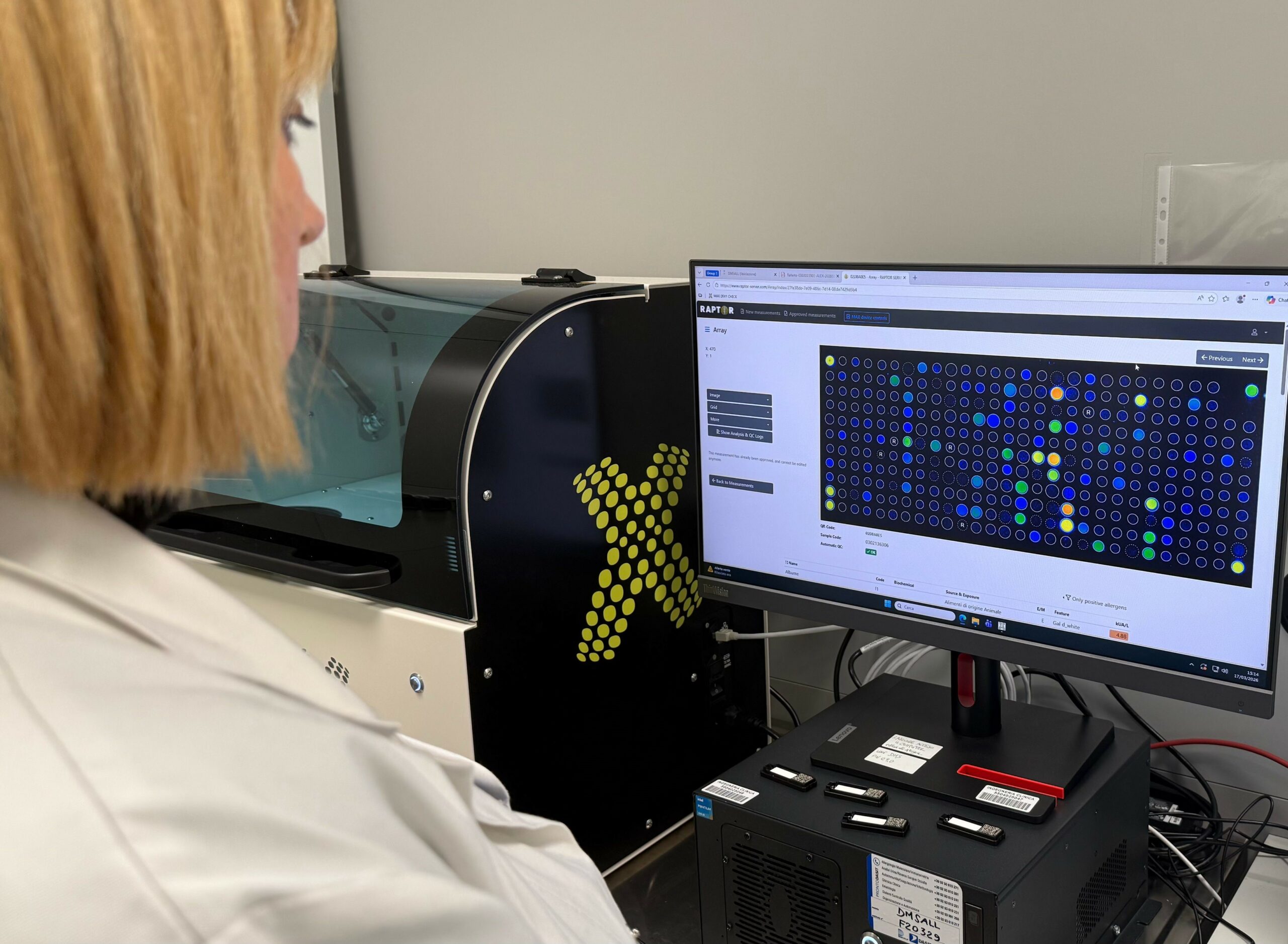 Immagine su analisi molecolari allergeni, di Ufficio Stampa Ospedale Pediatrico Bambin Gesù di Roma